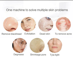 5-in-1 Electric Blackhead Remover - Rechargeable Vacuum Suction for Deep Facial Pore Cleaning
