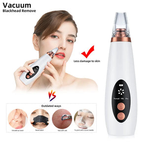 5-Head Pore Cleanser Vacuum - Electric Suction Acne Remover Tool Kit with Comedo Extractor and Blackhead Remover