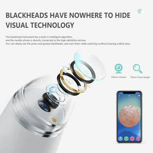 2024 Newest Blackhead Remover - Pore Vacuum Cleaner with Camera"