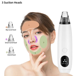 5-Head Pore Cleanser Vacuum - Electric Suction Acne Remover Tool Kit with Comedo Extractor and Blackhead Remover