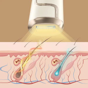 Mini Portable IPL Laser Hair Removal Device - Multifunction Rejuvenation Machine for Men
