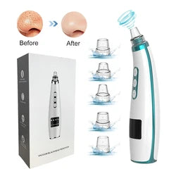 5-in-1 Electric Blackhead Remover - Rechargeable Vacuum Suction for Deep Facial Pore Cleaning