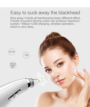 5-in-1 Electric Blackhead Remover - Rechargeable Vacuum Suction for Deep Facial Pore Cleaning