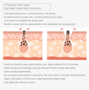 5-in-1 Electric Blackhead Remover - Rechargeable Vacuum Suction for Deep Facial Pore Cleaning