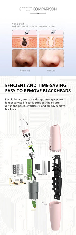 2024 Newest Blackhead Remover - Pore Vacuum Cleaner with Camera"